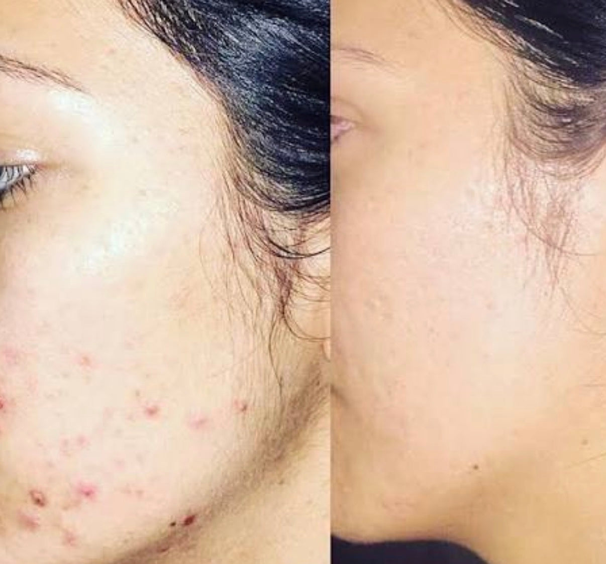 Soap Brightening & Cleansing Bar