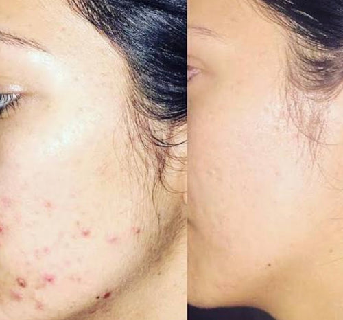 Gloss' Skin Brightening Face Cream